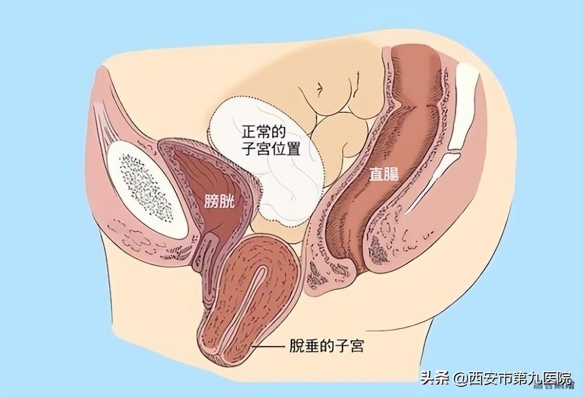 睪丸下垂松弛的原因及治療方法，睪丸下垂松弛的原因與治療方法解析