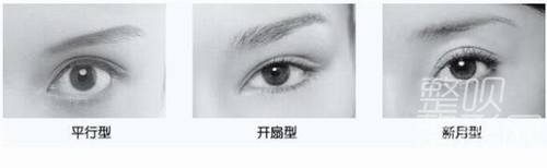 平扇與開扇雙眼皮，哪種更適合你？哪個更好看？，雙眼皮手術，平扇與開扇風格的選擇與美觀度探討