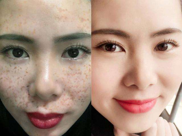 淡斑效果最好的產(chǎn)品與方法，安全與效果的完美結(jié)合，淡斑最佳產(chǎn)品與方法，安全效果完美結(jié)合之選