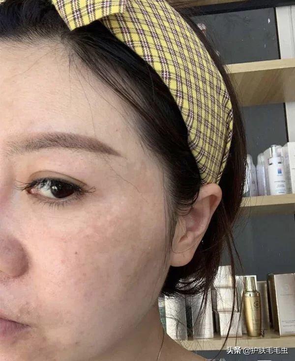 怎樣有效的淡化黃褐斑——全方位美白祛斑攻略，全方位美白祛斑攻略，如何有效淡化黃褐斑