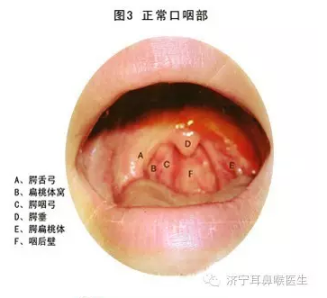 慢性咽炎三天斷根，真相還是幻想？，慢性咽炎三天斷根，真相還是幻想？揭秘治療真相。