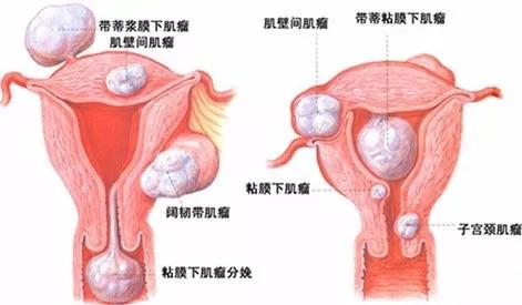 正常宮頸口的照片，了解、識(shí)別與關(guān)注女性健康，女性健康知識(shí)普及，正常宮頸口照片，識(shí)別與關(guān)注宮頸健康
