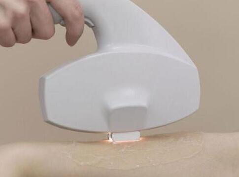 激光脫毛一次大概需要多少錢(qián)？詳解費(fèi)用因素與個(gè)人化差異，激光脫毛費(fèi)用詳解，價(jià)格因素與個(gè)人化差異探究