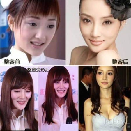 哪些女明星整容？深度解析背后的故事，深度解析女明星整容背后的故事