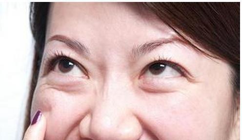 如何消除眼袋，方法與技巧詳解，消除眼袋的有效方法與技巧全解析
