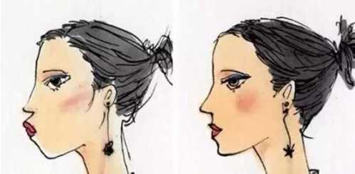 鼻子整形后能否永久保持？全面解析鼻子整形手術(shù)的持久性，鼻子整形手術(shù)的持久性與永久保持的可能性解析