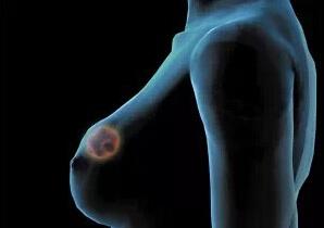 乳腺癌患者的生存期，了解與面對(duì)，乳腺癌患者的生存期，了解與面對(duì)的挑戰(zhàn)
